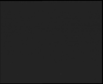 SkiAreál - Horský hotel...