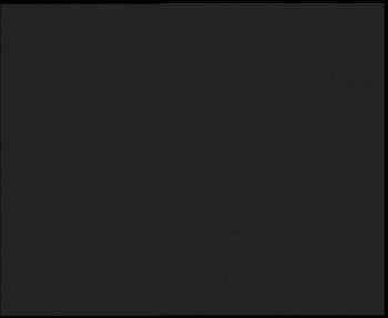 SkiAreál - Horský hotel...