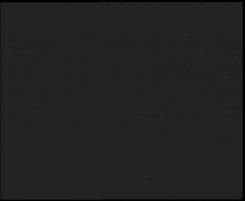 SkiAreál - Horský hotel...