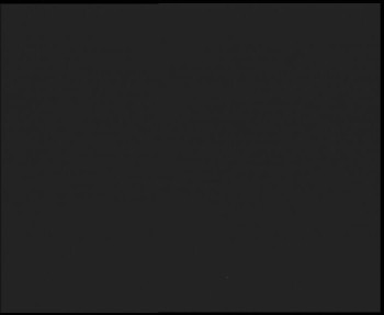 SkiAreál - Horský hotel...