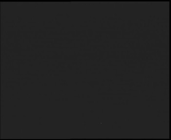 SkiAreál - Horský hotel...