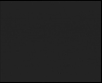 SkiAreál - Horský hotel...