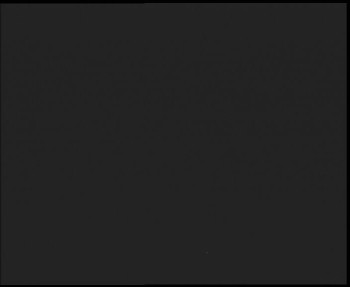 SkiAreál - Horský hotel...