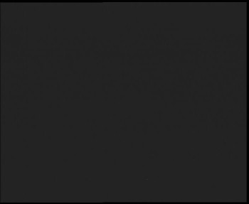 SkiAreál - Horský hotel...