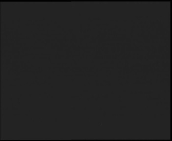 SkiAreál - Horský hotel...