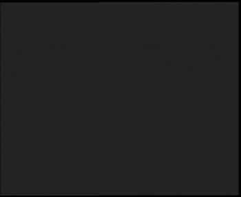 SkiAreál - Horský hotel...