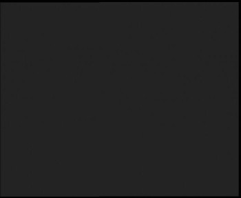 SkiAreál - Horský hotel...