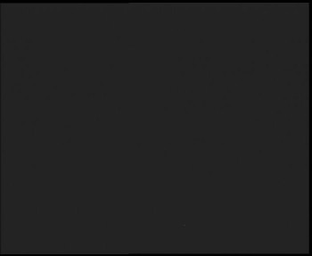 SkiAreál - Horský hotel...