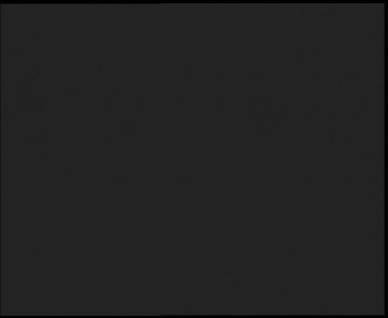 SkiAreál - Horský hotel...