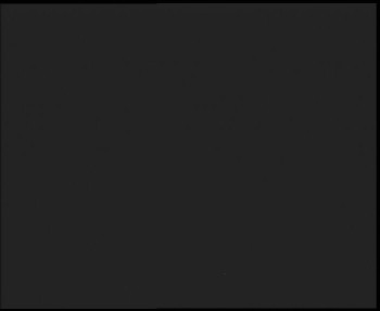 SkiAreál - Horský hotel...