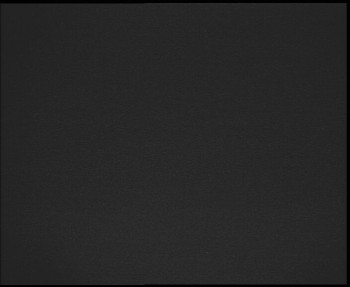 SkiAreál - Horský hotel...