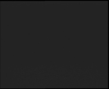 SkiAreál - Horský hotel...