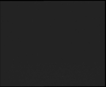 SkiAreál - Horský hotel...