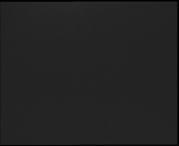 SkiAreál - Horský hotel...