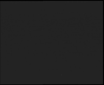 SkiAreál - Horský hotel...