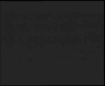 SkiAreál - Horský hotel...