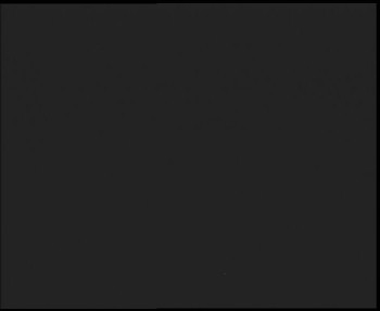 SkiAreál - Horský hotel...