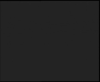 SkiAreál - Horský hotel...