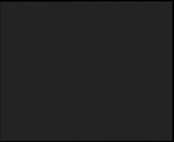 SkiAreál - Horský hotel...