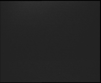 SkiAreál - Horský hotel...