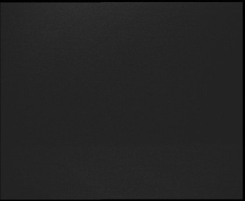 SkiAreál - Horský hotel...