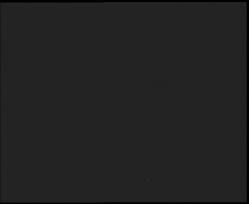 SkiAreál - Horský hotel...