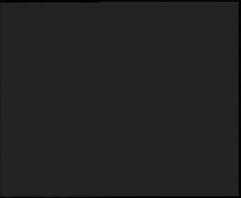 SkiAreál - Horský hotel...