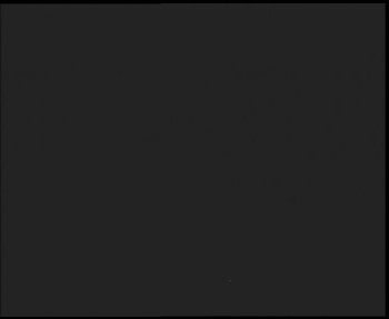 SkiAreál - Horský hotel...