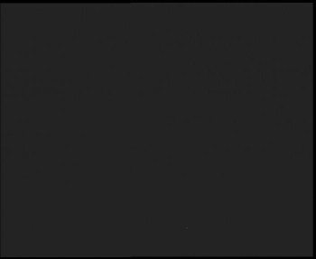 SkiAreál - Horský hotel...