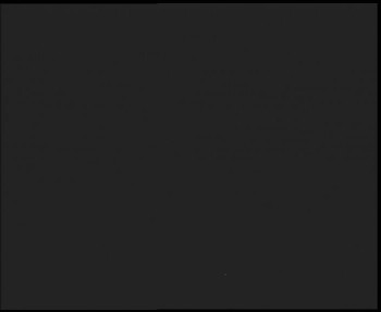 SkiAreál - Horský hotel...