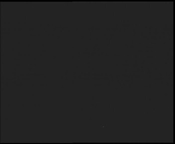 SkiAreál - Horský hotel...