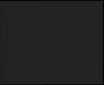 SkiAreál - Horský hotel...