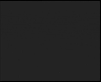 SkiAreál - Horský hotel...