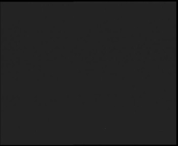 SkiAreál - Horský hotel...