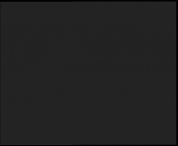 SkiAreál - Horský hotel...