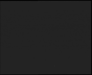 SkiAreál - Horský hotel...