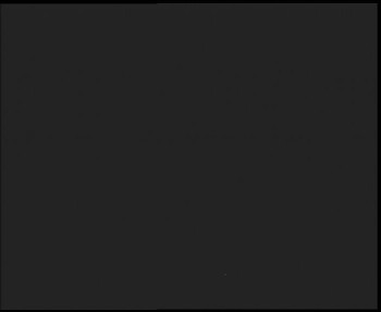 SkiAreál - Horský hotel...