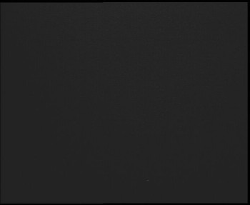 SkiAreál - Horský hotel...