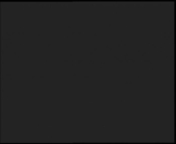 SkiAreál - Horský hotel...