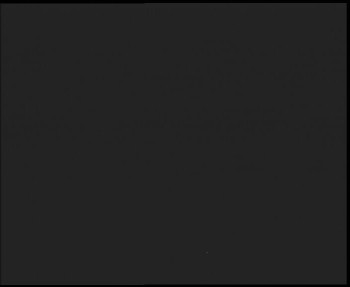 SkiAreál - Horský hotel...