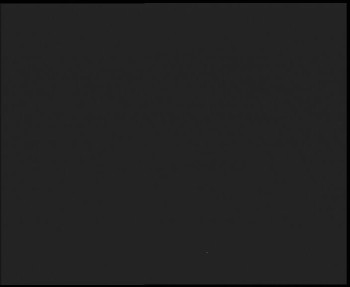 SkiAreál - Horský hotel...