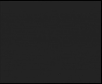 SkiAreál - Horský hotel...