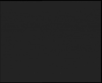 SkiAreál - Horský hotel...