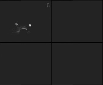 SkiAreál - Horský hotel...