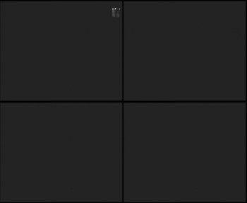 SkiAreál - Horský hotel...