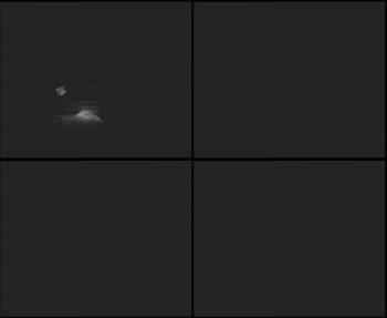 SkiAreál - Horský hotel...