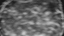 Bílá - běžecká trať