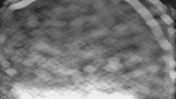 Lyžařské svahy, Smrk, Lysá hora