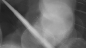 Bludný - Rajnochovice Troják