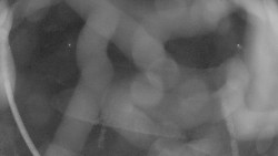 Areál koupaliště Holešov